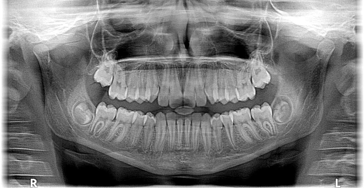 Diagnostyka jamy ustnej – dlaczego warto wykonać zdjęcie rentgenowskie